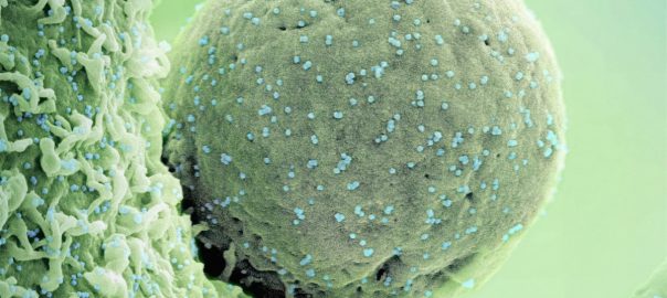 Novel Coronavirus SARS-CoV-2 (Omicron) Colorized scanning electron micrograph of a cell (green) infected with the Omicron strain of SARS-CoV-2 virus particles (blue), isolated from a patient sample. Image captured at the NIAID Integrated Research Facility (IRF) in Fort Detrick, Maryland. Credit: NIAID https://www.flickr.com/photos/niaid/53428060492/
